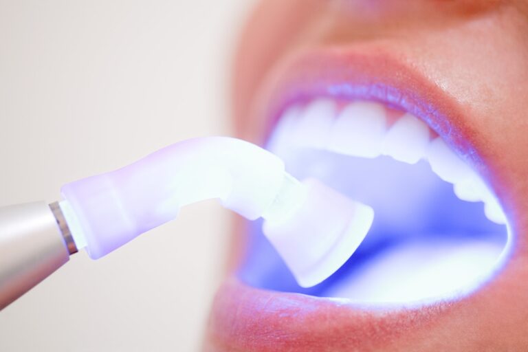 The image shows a close-up of a mouth with a dental instrument that has a laser being used during a dental procedure.