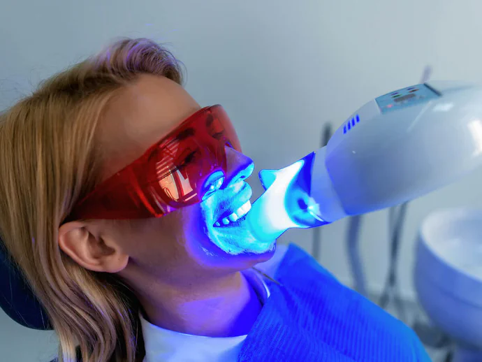 Teeth whitening in Oak Lawn, IL at Roots Dental Studio.