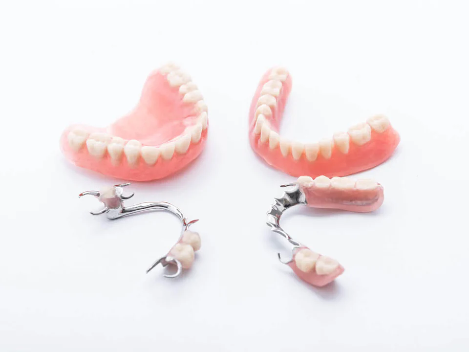Full and partial dentures in Oak Lawn, IL at Roots Dental Studio.
